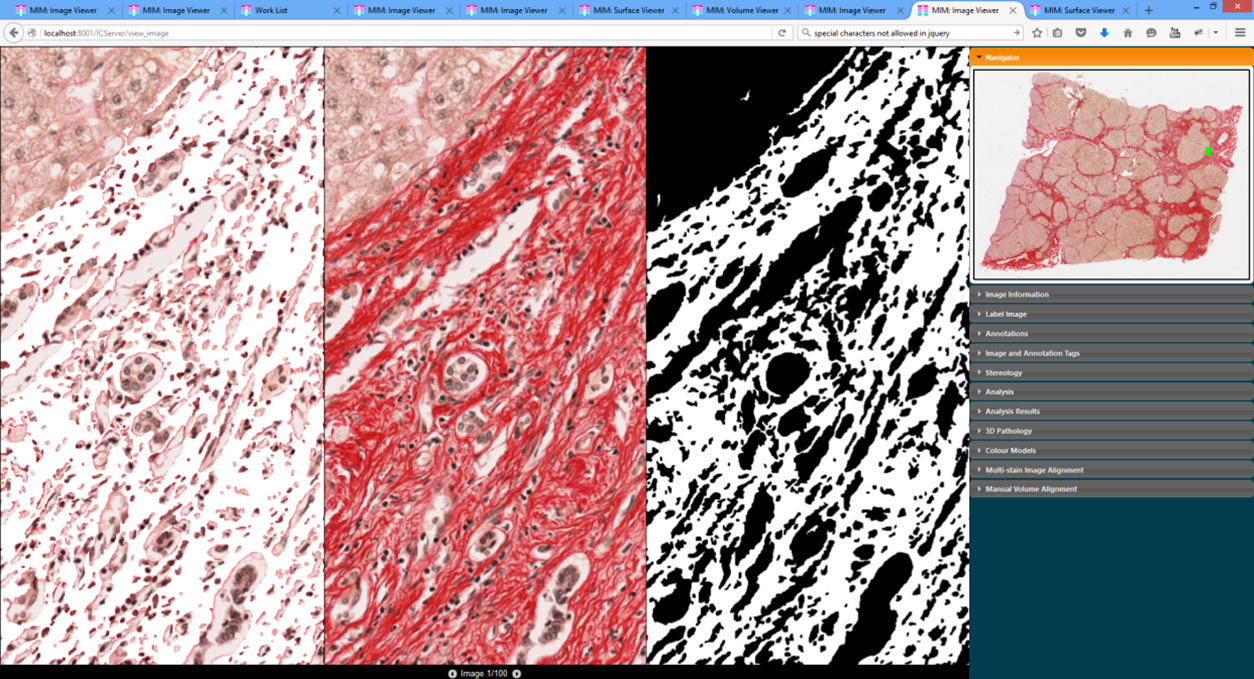 Hetero<strong>Genius</strong> Tissue Quantification Overlay